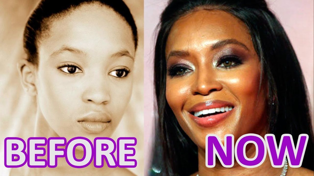 Naomi Campbell Plastic Surgery