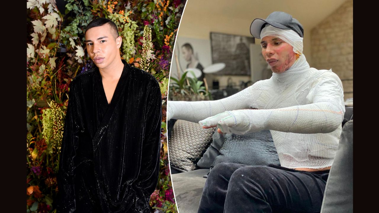 Olivier Rousteing Plastic Surgery