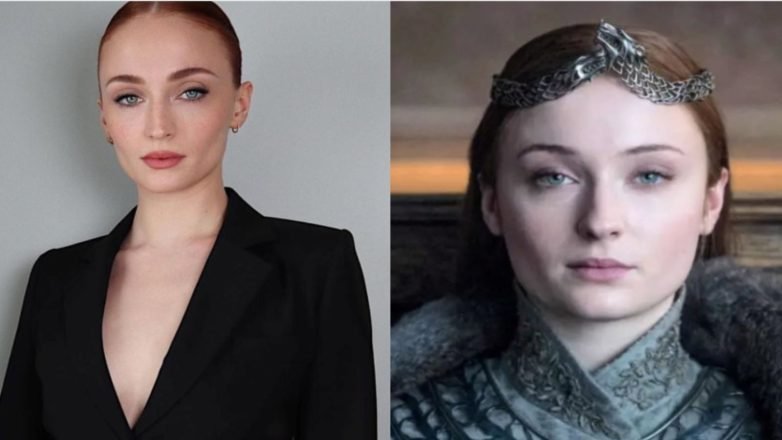 sophie turner plastic surgery Image 4