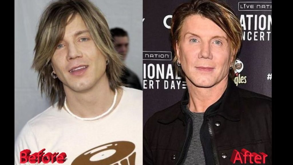 did-johnny-rzeznik-have-plastic-surgery-where-is-johnny-rzeznik-now