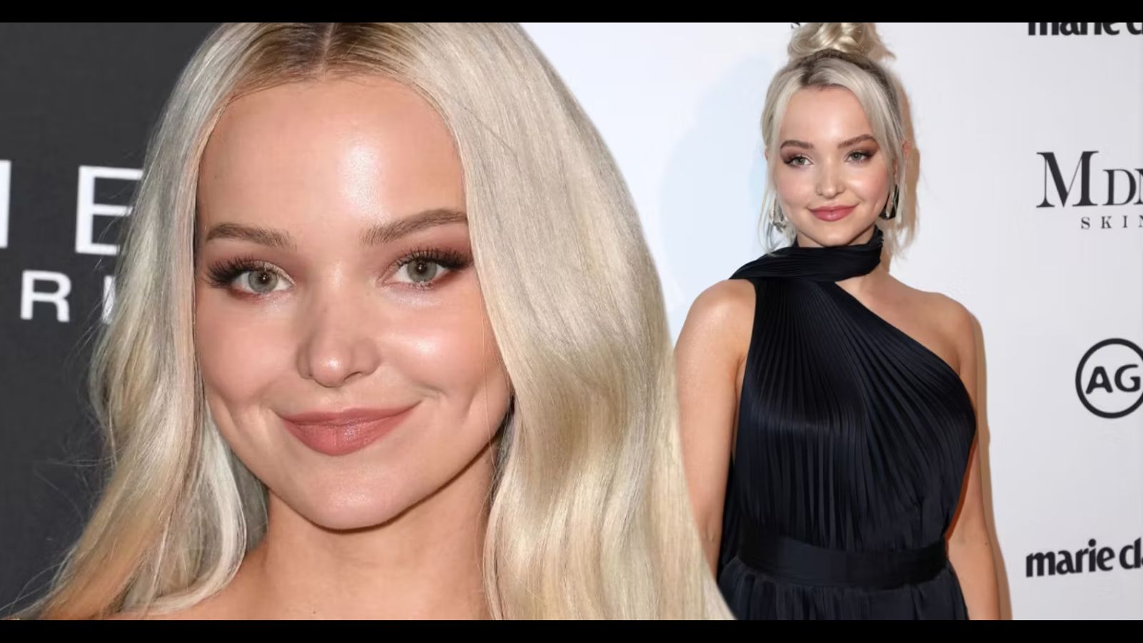 Dove Cameron Lip Filler Isn’t Just Rumor